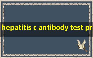 hepatitis c antibody test price